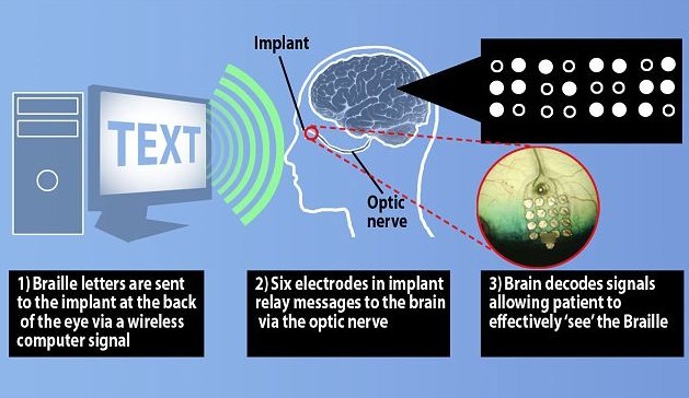 New technology allows the blind to "see" words, which is expected to benefit many blind people.